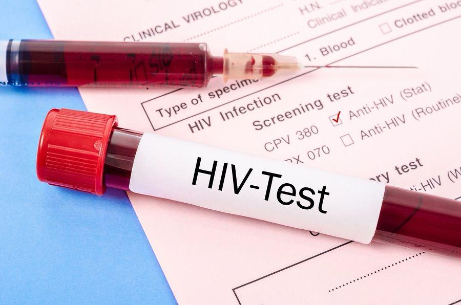 HIV Management