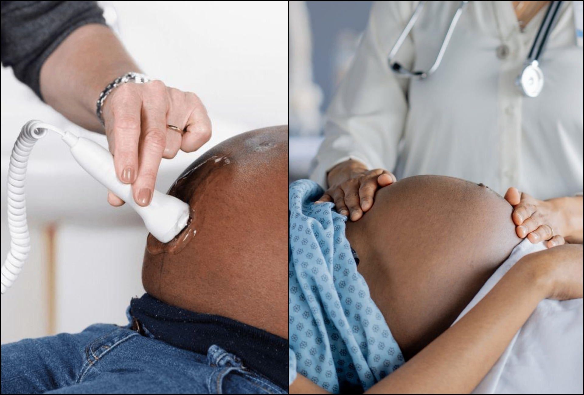 Antenatal Care & Pregnancy Ultrasound